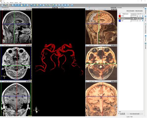 Cranial MRI and corresponding sectional anatomy. The left side is the ...