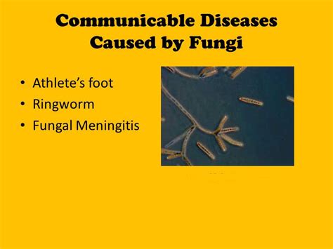 Disease Caused By Fungi In Human Body मानव शरीर मे फफूंद से होने वाले रोग - short trick ...