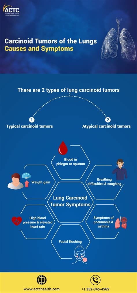 Lung Carcinoid Tumor Causes and Symptoms | ACTC