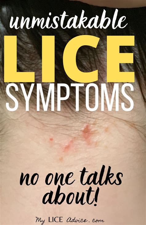 17 Lice Symptoms with Pictures: Signs That You Have Head Lice in 2020 | Head louse, Head itch, Louse