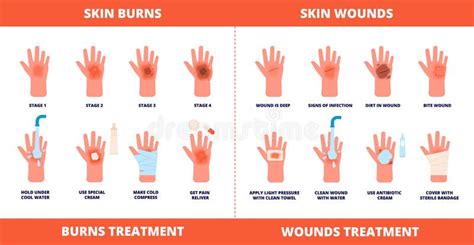 Skin First Aid. Burns Treatment, Wounds and Trauma Symptoms Stock Vector - Illustration of ...