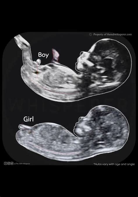 Your First Ultrasound Can Tell The Gender Of Your Baby? - Ur Baby Blog