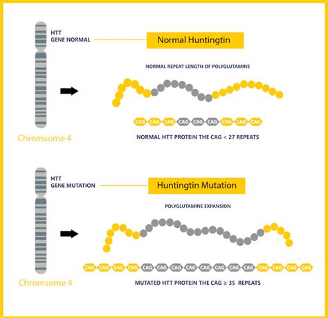 Huntington’s Disease Research: Shutting down the mutant gene – HudsonAlpha Institute for ...