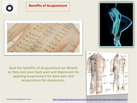 PPT - Acupuncture For Back Pain PowerPoint Presentation, free download ...