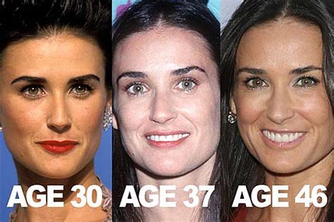 Demi Moore Plastic Surgery Before and After Nose Job and Botox - Star ...