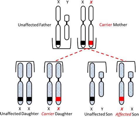 Hemophilia | American Society for Clinical Laboratory Science