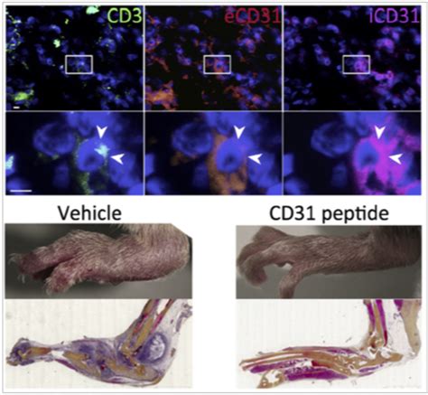 CD31 in the immunological synapse – LVTS UMRS1148 INSERM UP Cité USPN