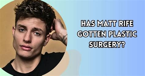 Matt Rife Gotten Plastic Surgery? Several Changes Over the Years