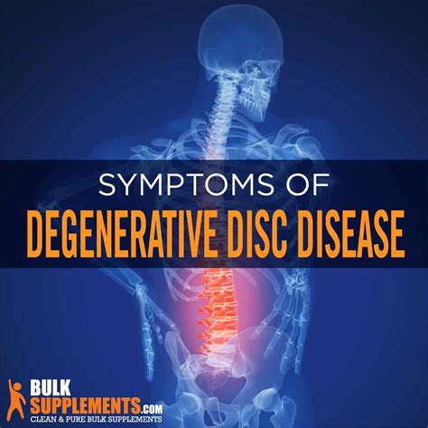 Degenerative Disc Disease: Symptoms, Causes & Treatment