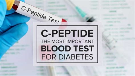 C peptide Test: Working, Results, Complications And Benefits