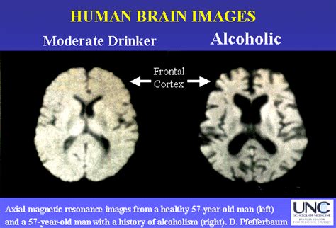 Growing Up Sober: The Effects of Alcohol Abuse