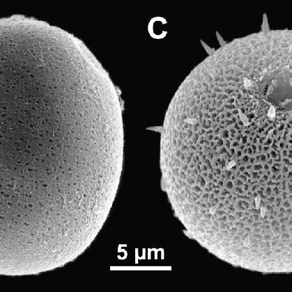 Loricae showing different shape and ornamentation (SEM; all at the same ...