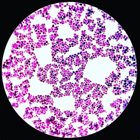 Candida albicans Gram stain. | Candida albicans, Candida, Microbiology