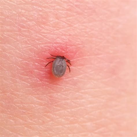 Ticks In The House | Renew Physical Therapy