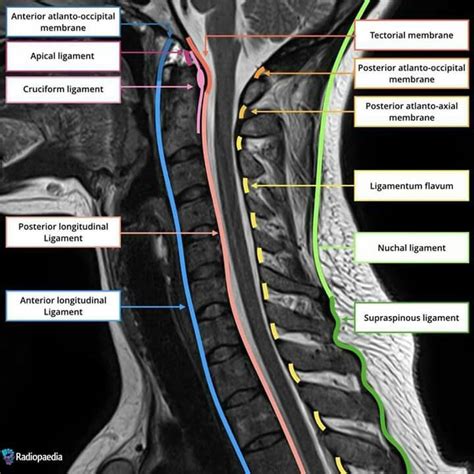 Pin on Física Médica | Anatomy, Medical radiography, Medical anatomy