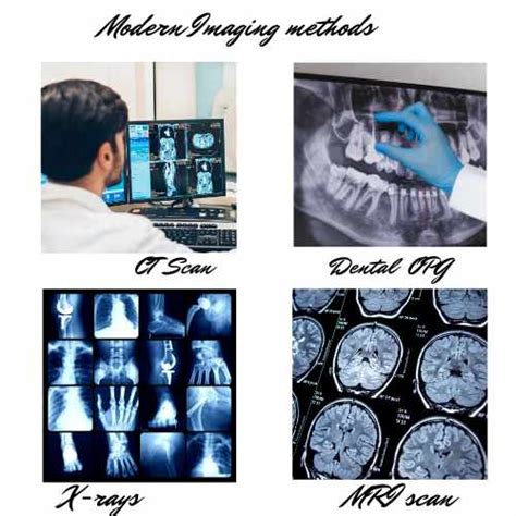 From X-rays To Mri's-exploring The Various Imaging Techniques ...