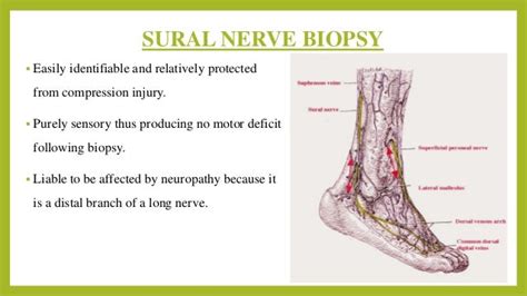 Interpretation of nerve biopsy