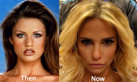 Katie Price Plastic Surgery Before and After Photos