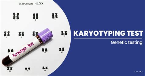 Karyotyping test - Purpose and Procedure