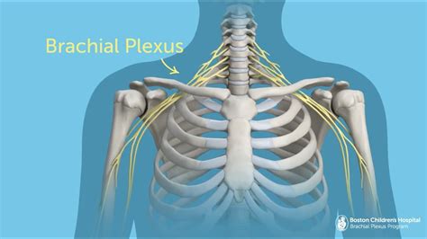 Brachial Plexus Injury Diagnosis Brachial Plexus Products Diagnosis | Images and Photos finder