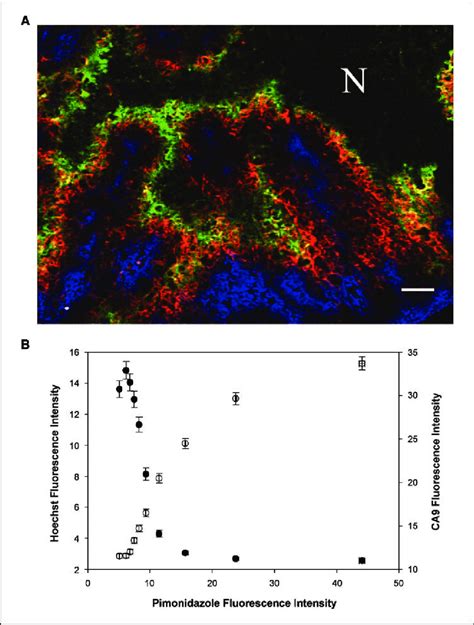 A, representative fluorescence overlay image [pimonidazole (green ...