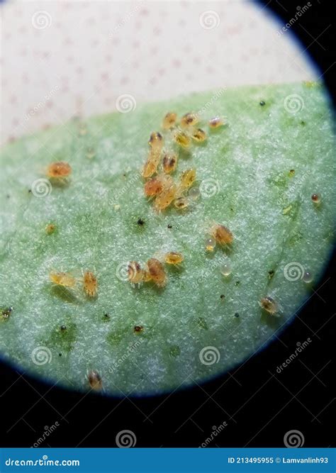 Ear Mite Eggs Under The Microscope Stock Photography | CartoonDealer.com #189677270