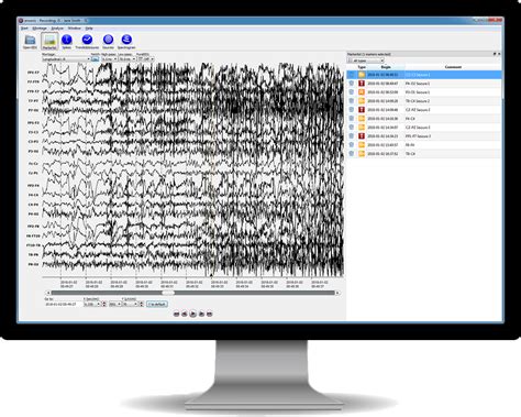 EEG viewing software - encevis