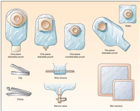 Pouching A Colostomy