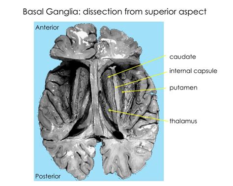 Lab Week 5: Basal Ganglia and Cerebellum – Rehab 551 Lab