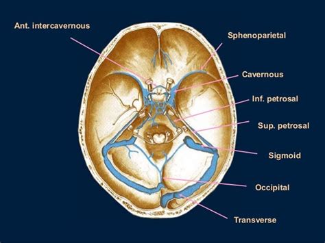 70以上 dural sinuses labeled 195691-What is dural sinus