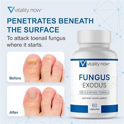 Vitality Now Fungus Exodus - 60 Capsules for Healthier Feet | Premium Formula