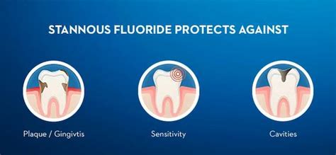 Difference Between Sodium Fluoride And Sodium Monofluorophosphate - Relationship Between