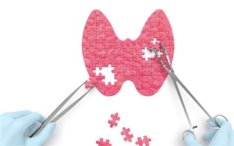 Iodine Deficiency: Symptoms, Causes, and Treatment Options