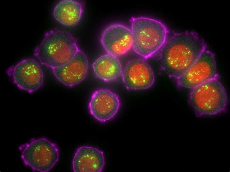 RNA FISH for cancer targets | LGC Biosearch Technologies