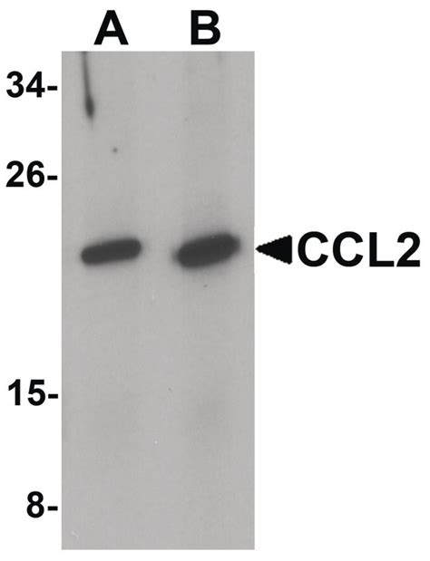 MCP-1 Antibody (PA5-34505)