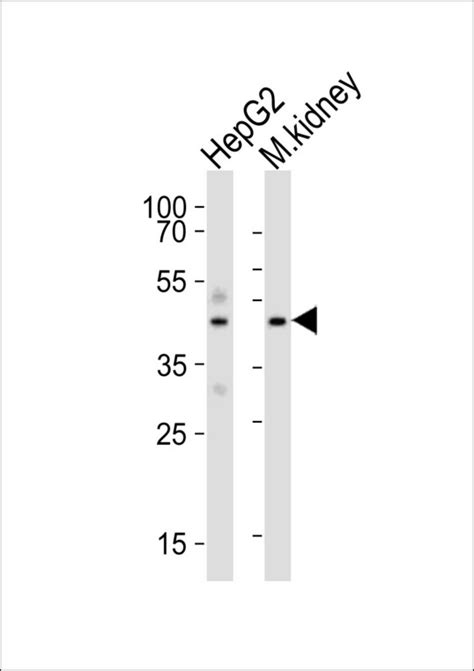 Anti-DNASE1 / DNase I Antibody | Rabbit anti-Human Polyclonal | LSBio