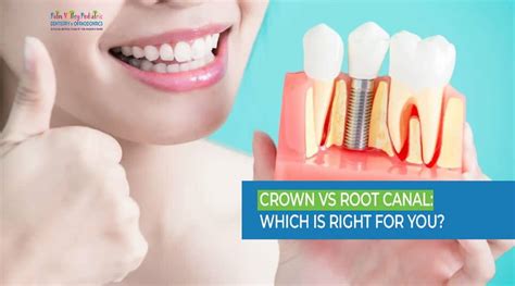 Crown vs Root Canal: Which Dental Procedure is Right for You?