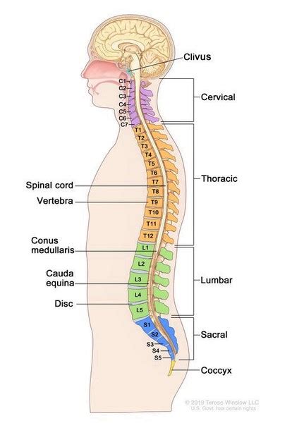 Intervertebral disc disease: MedlinePlus Genetics