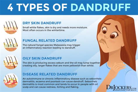 Dandruff: Root Causes and Support Strategies - DrJockers.com