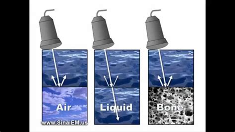 Ultrasound Basics - YouTube