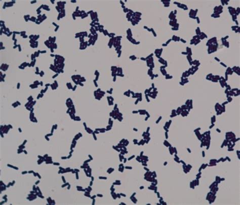 Clostridium Gram Stain