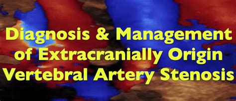 Diagnosis & Management of Extracranially Origin Vertebral Artery Stenosis - Echovision