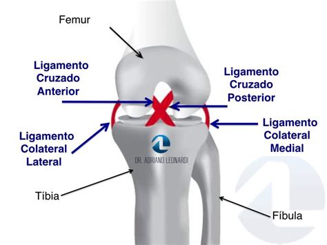 O que é Ligamento Cruzado Anterior - LCA - Especialista do Joelho