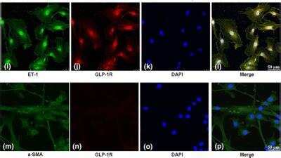 GLP-1R Antibody - BSA Free (NLS1205): Novus Biologicals