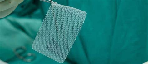 Hernia Mesh Lawsuit - Mass Torts Central