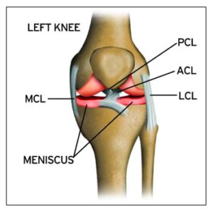 MCL Surgery, Repair & Treatment – Knee Pain & Injuries