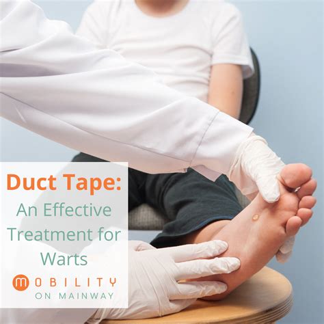 Planters Wart Removal Duct Tape | Bruin Blog