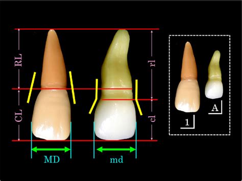 Morphological differences between deciduous teeth and their successors ...