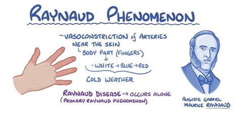 Vasoconstriction: What Is It, Causes, Signs, Symptoms, and More | Osmosis