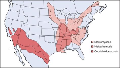 47 Cryptococcus, Histoplasma, Coccidioides, and Other Systemic Fungal Pathogens | Basicmedical Key
